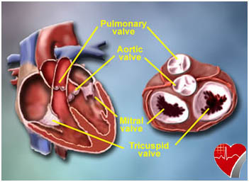 Heart Valve Repair in India : A Premier Healthcare Destination ...