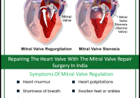 mitral valve repair or replacement surgery india